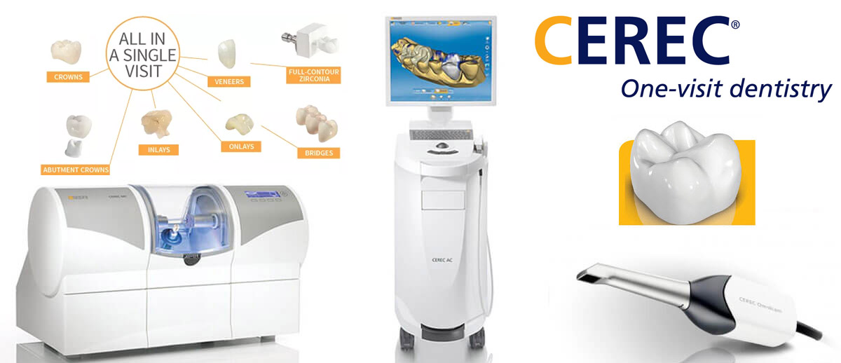 CERED Same Day Dental Restoration for Crowns, Veneers, Onlays and more